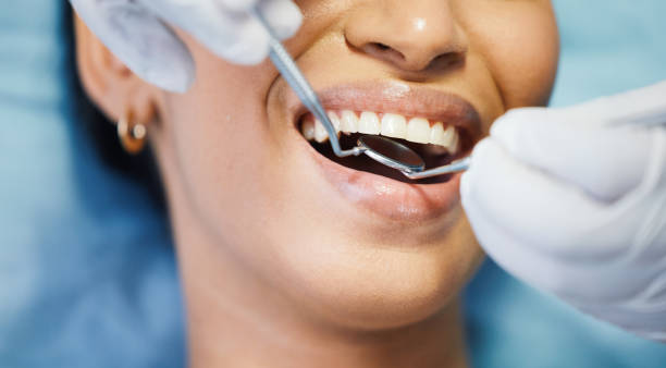 Best Weekend Emergency Dental Services in South Highpoint, FL